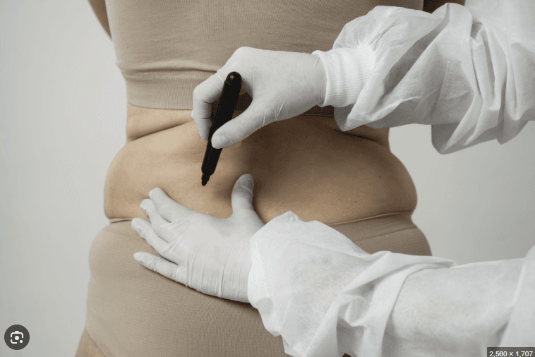 Vetoplossende Injecties behandeling bij Noor Clinics